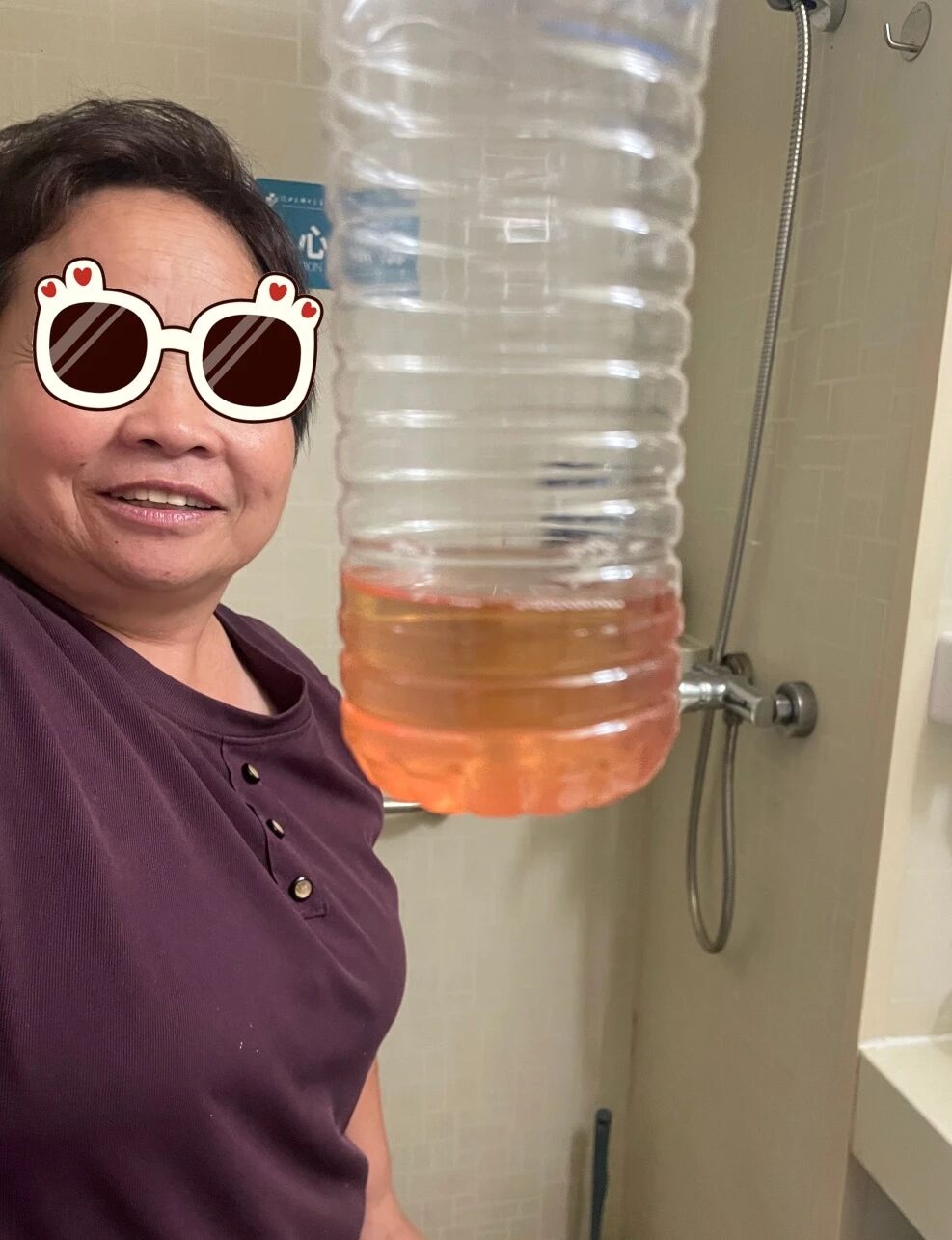 52 岁王先生的无尿逆袭战