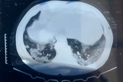 阜康医院呼吸内科提示：这份呼吸道传染病防控健康提示，请收好！