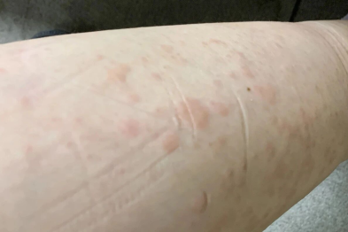 「光腿神器」怎么就成了「美丽刑具」？爱美的女士请注意