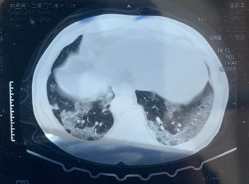 阜康医院呼吸内科提示:这份呼吸道传染病防控健康提示,请收好!