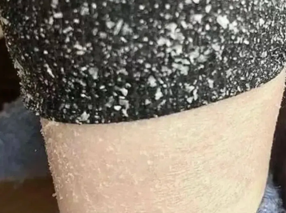 这种被夸大的「皮肤神药」，几乎家家都有，很多人都用错了