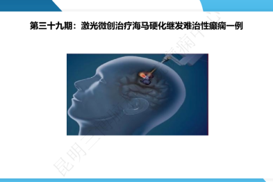 《「痫停」信步》癫痫治疗病例荟萃第三十九期---激光微创治疗海马硬化继发难治性癫痫一例