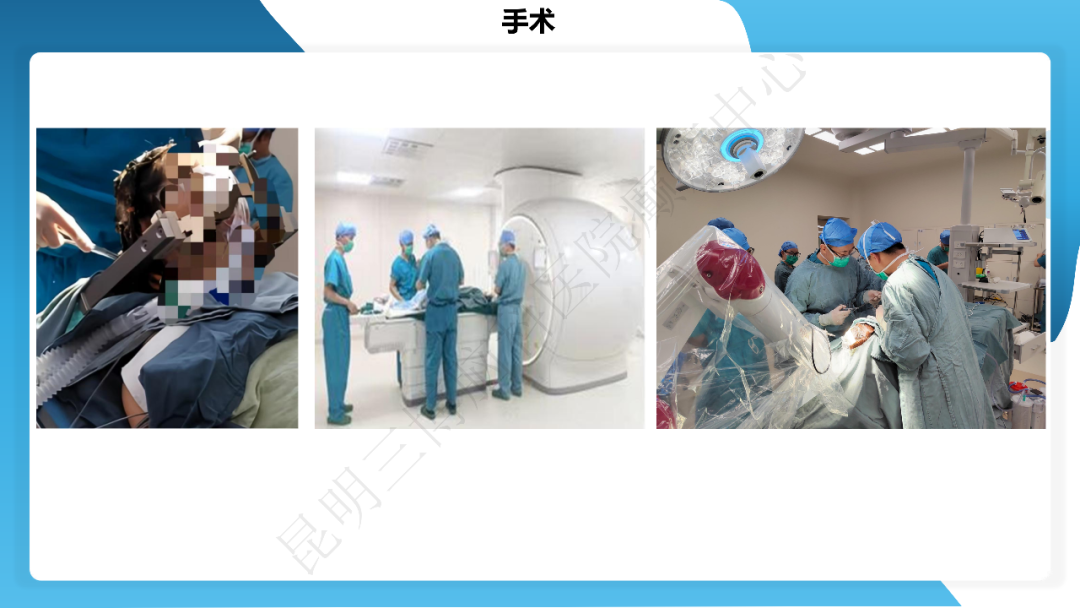 《「痫停」信步》癫痫治疗病例荟萃第三十九期---激光微创治疗海马硬化继发难治性癫痫一例