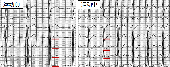 跑步机上跑几步，结果竟然不是为了健身？