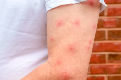 这种被夸大的「皮肤神药」，几乎家家都有，很多人都用错了