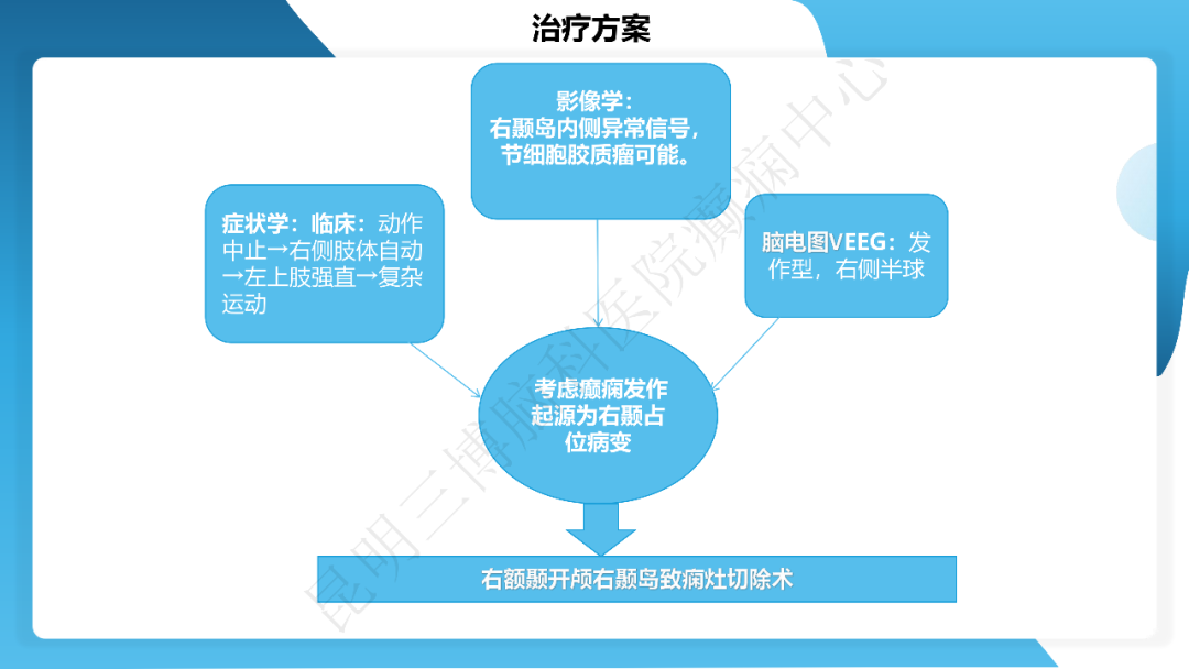 《「痫停」信步》癫痫治疗病例荟萃第四十期---手术治疗节细胞胶质瘤继发癫痫 1 例