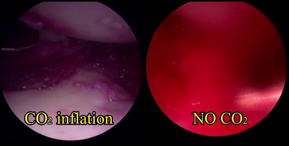 仁慈骨科 国际影响 | 齐伟亚主任团队在亚太腕关节学会手术视频大赛中赢取优胜