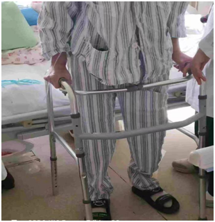 国际先进技术丨八旬老人髋部骨折，术后次日即可行走