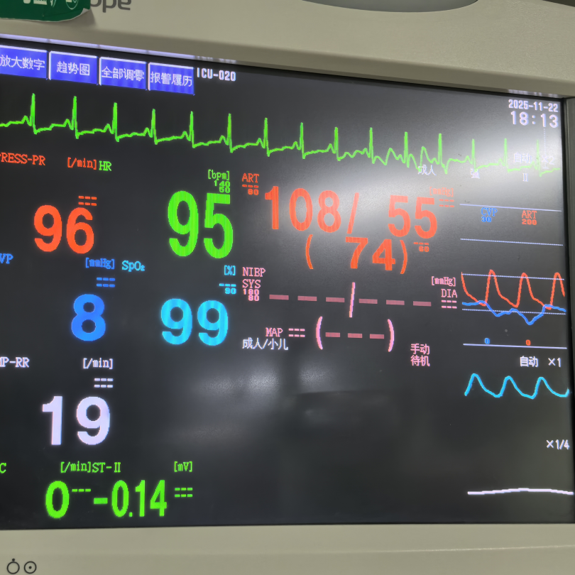 生命护航,高龄重症患者的「心」生之路——ECMO 加持下冠脉介入术再创奇迹