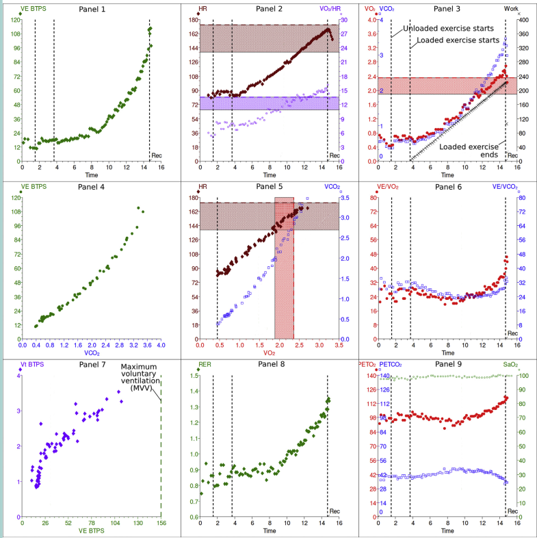 别只看静息心电图了!这项「动起来」的检查,才是真正的健康「预言家」