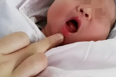 带一颗「鬼牙」出生！这个女童天生不一样？