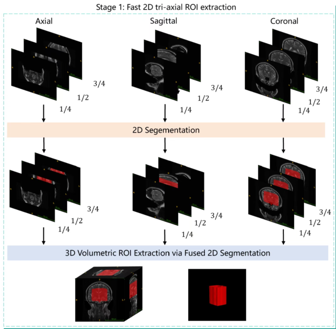 一脉阳光赋能影禾医脉,斩获 RSNA 颅内动脉瘤 AI 挑战赛全球亚军