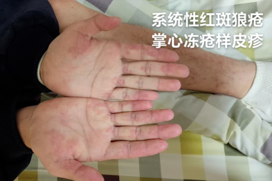她因「不死的癌症」去世，年仅 59 岁！这种病专挑女性下手，这些事你必须知道