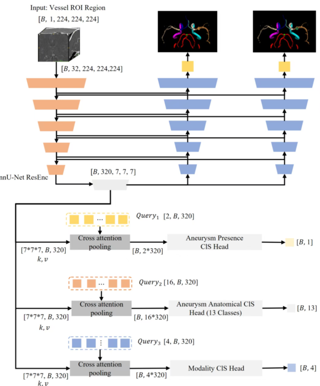 一脉阳光赋能影禾医脉,斩获 RSNA 颅内动脉瘤 AI 挑战赛全球亚军