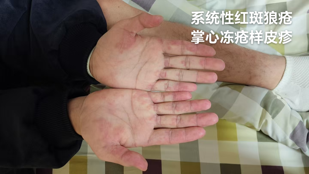 她因「不死的癌症」去世,年仅 59 岁!这种病专挑女性下手,这些事你必须知道
