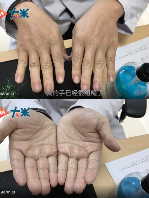 儿科医生罗志华:一双「绿手」书写医者仁心,日均百次洗手守护儿童健康