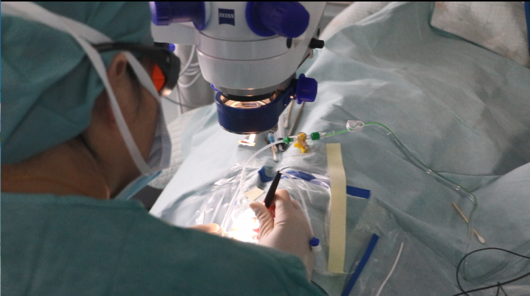 手术室上演「高清 3D 导航大片」眼科精准手术让眼底病灶纤毫毕现