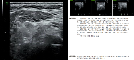 同质精准！西交大一附院陆港院区超声医学科甲状腺穿刺技术再攀新高度