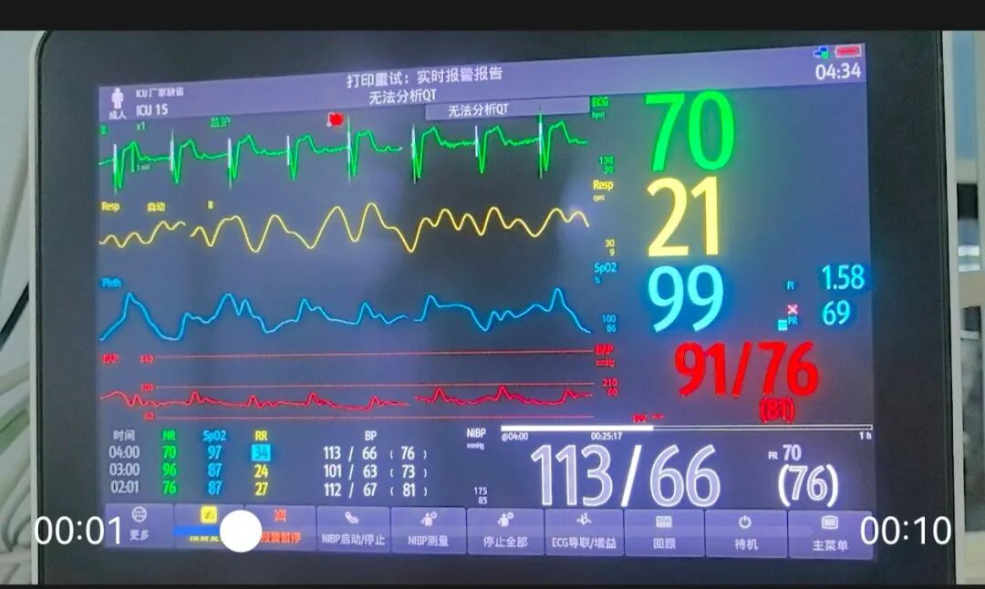 漳州 30 岁男子感冒硬扛 4 天,竟进 ICU 抢救!