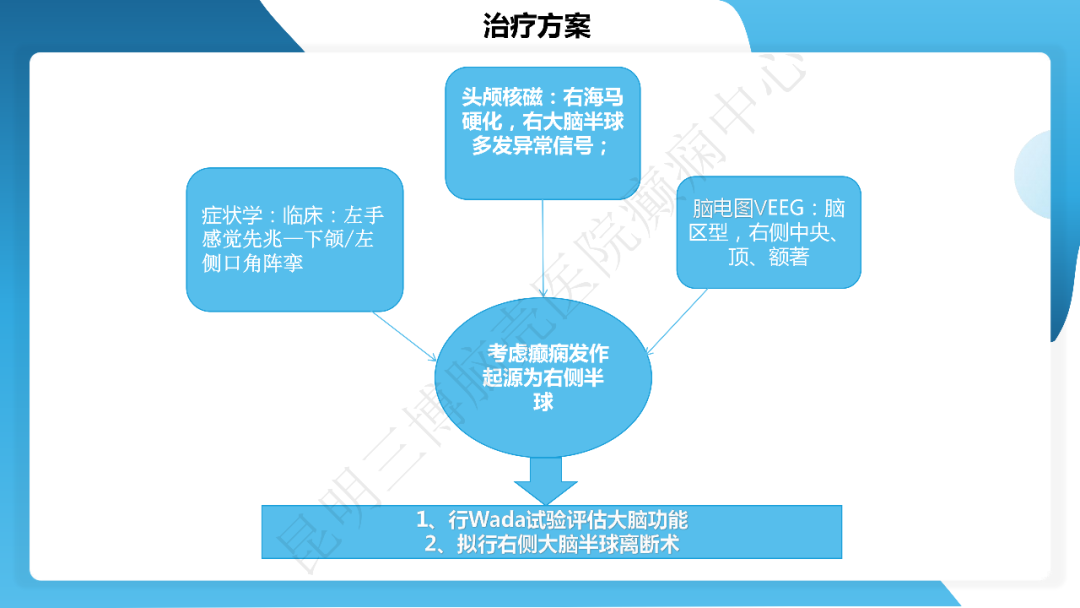 《「痫停」信步》癫痫治疗病例荟萃第四十一期---大脑半球离断术治疗 Rasmussen 脑炎引起的难治性癫痫一例