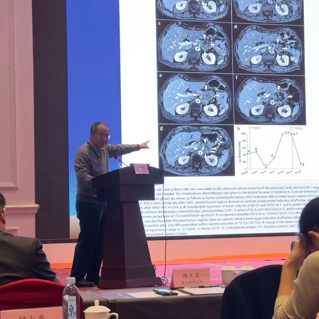 重庆海扶医院陈文直教授安徽开讲 赋能中医药肿瘤诊疗新未来