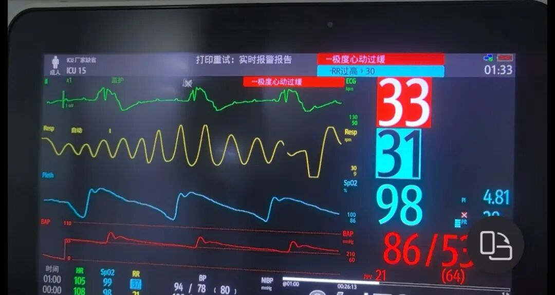 漳州 30 岁男子感冒硬扛 4 天,竟进 ICU 抢救!
