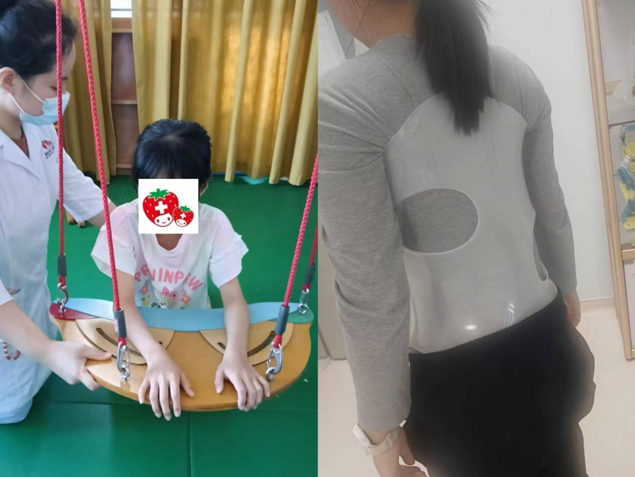 16 岁女孩查出脊柱侧弯 27 度!妈妈做出一个决定...