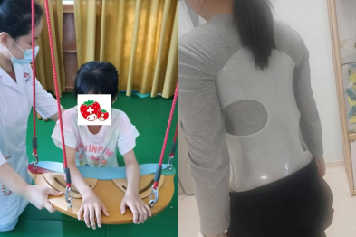 16 岁女孩查出脊柱侧弯 27 度！妈妈做出一个决定...