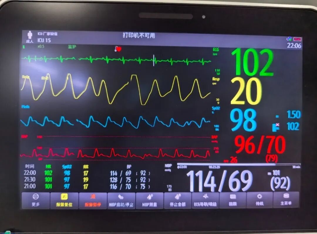漳州 30 岁男子感冒硬扛 4 天,竟进 ICU 抢救!