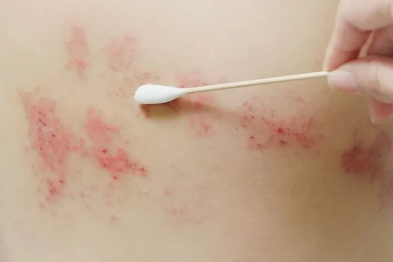 知名女星自曝患病，冲上热搜！年轻人也会得，比生娃还疼