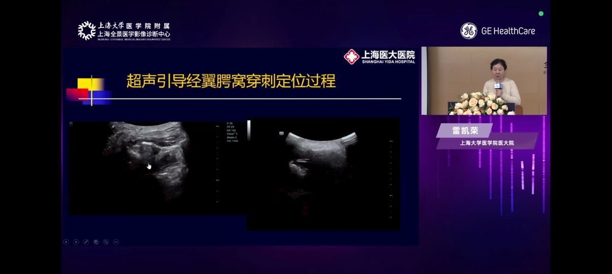 聚中欧医研之力 融医疗级深度检 ——「探肌寻声」肌骨超声诊断研讨会于上海全景圆满举行