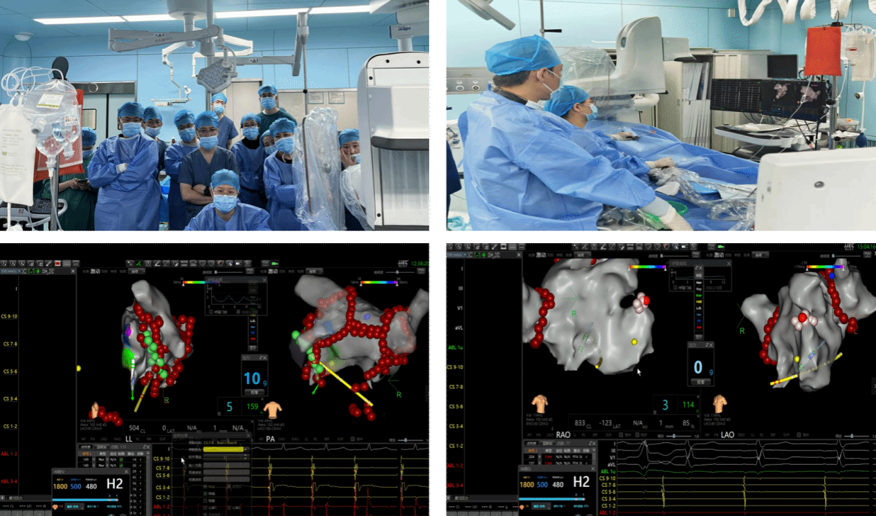 全国第二、西北第一所 CDQI 心房颤动脉冲电场消融规范化诊疗培训基地在我院揭牌