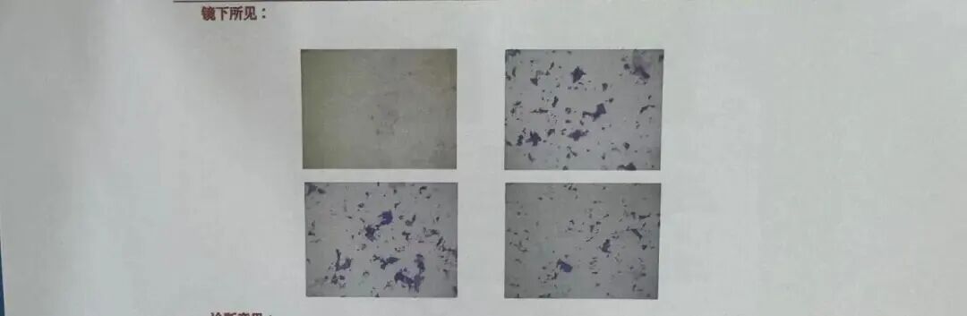 偶像剧男星立威廉发文回应患癌，为何被甲状腺癌缠上的年轻人越来越多