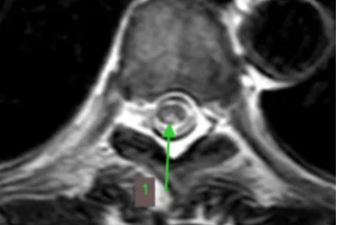 从「美酒」到「毒药」，这个病例给你敲响警钟！