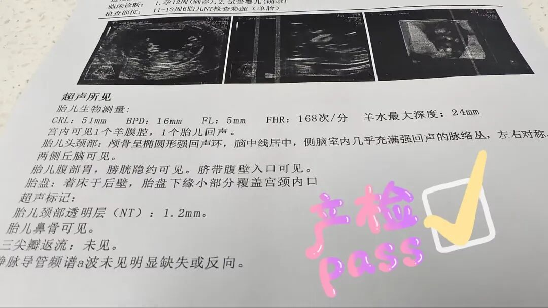5 年求子难?这次换刘冬娥教授帮她减重 20 斤再试管,终于怀上!