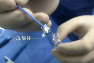 当眼睛「空间有限」遇上超高度近视：一例小角膜合并浅前房的 ICL 手术案例