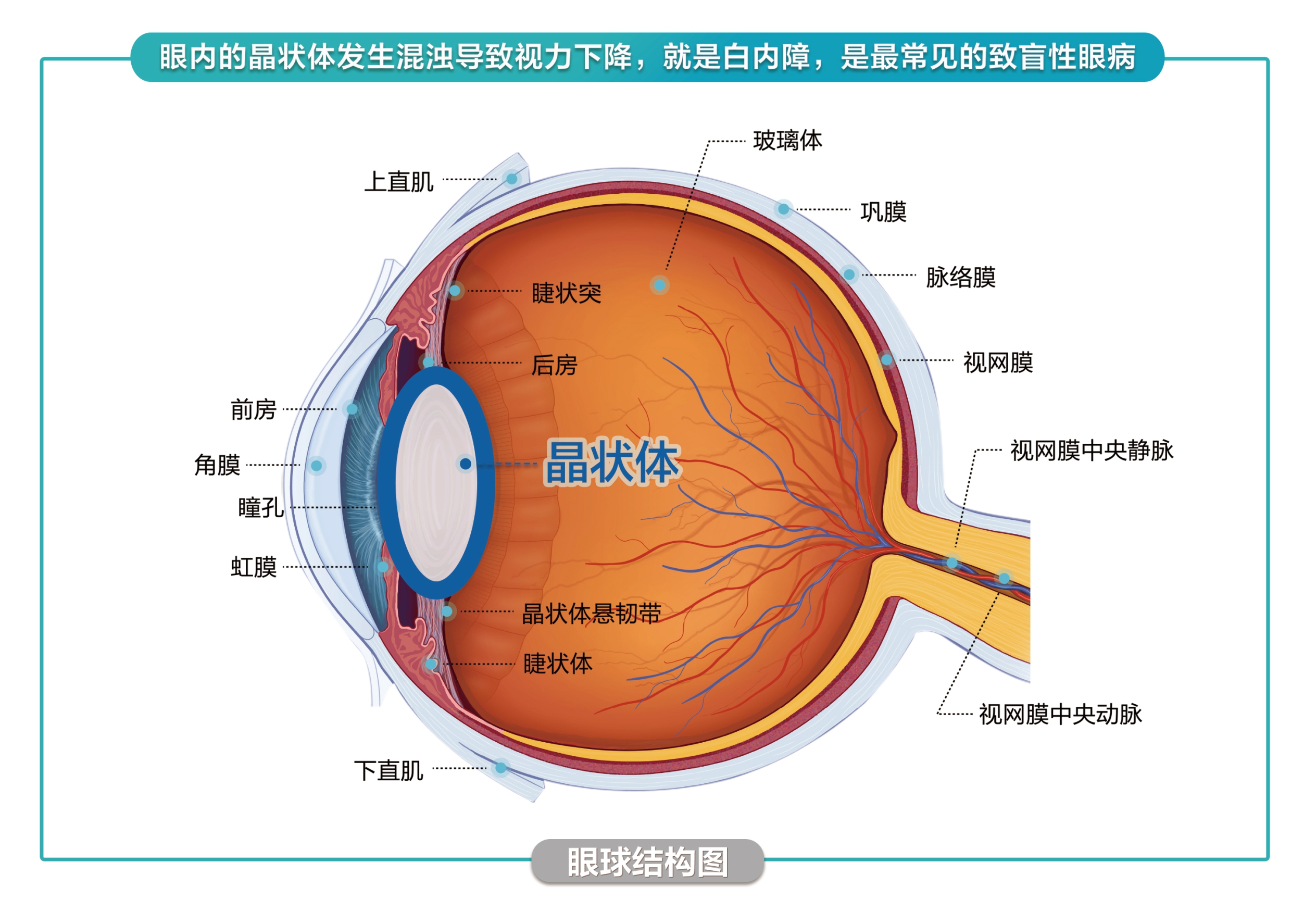 医心仁术解沉疴 公益之光暖民心——我院成功为重度驼背患者实施高难度白内障手术