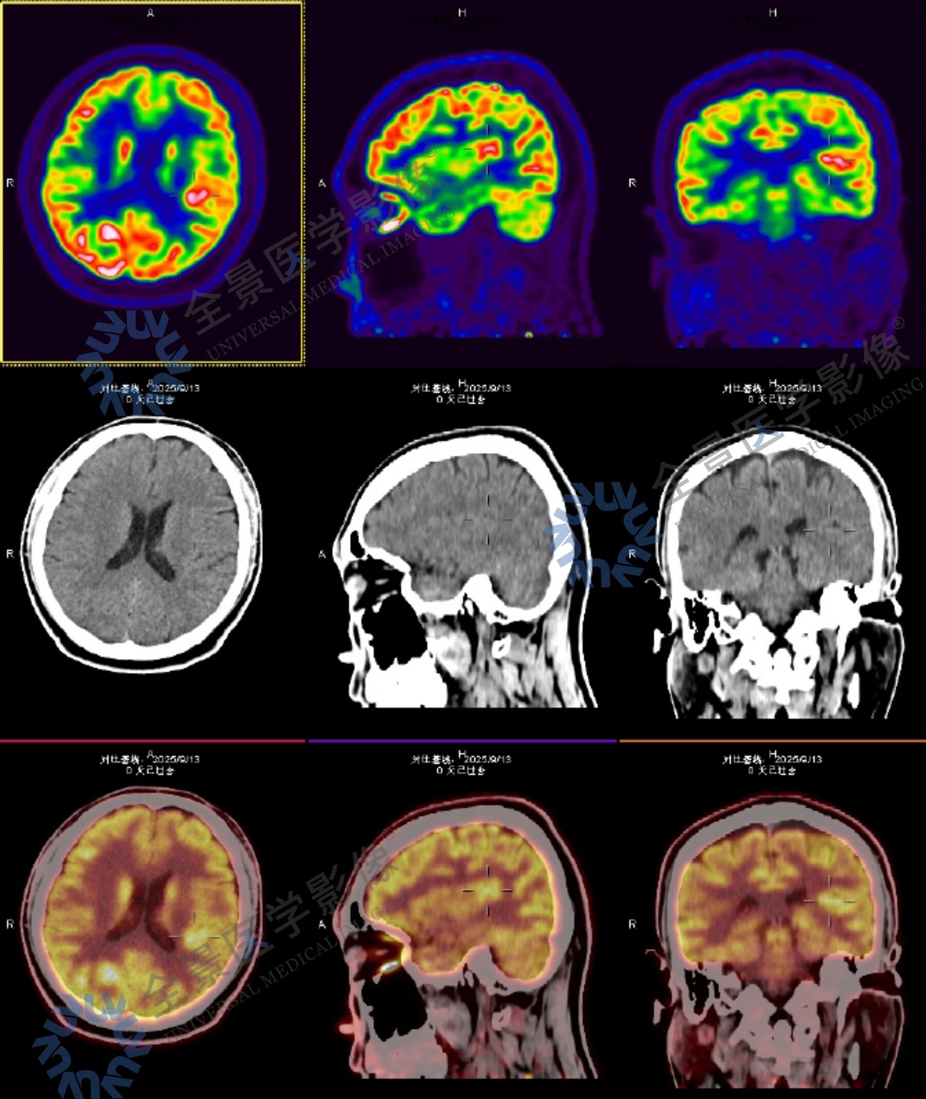 持续 6 年的「眩晕症」，遍查无果后终于找到了答案