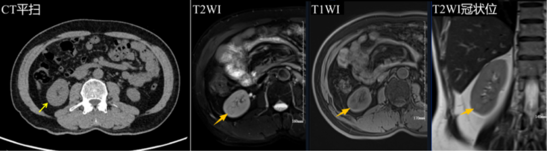 影像诊断的「关键 24 小时」:一次异常信号的快速追踪