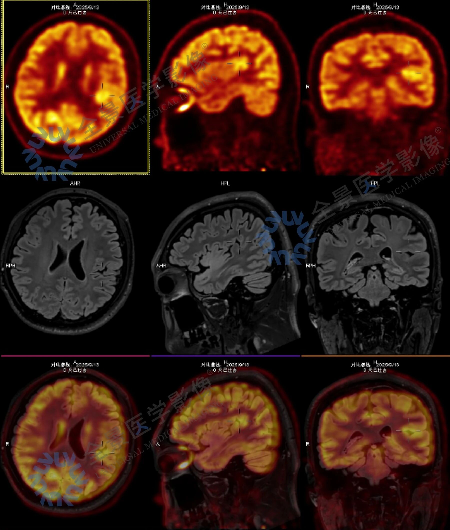 持续 6 年的「眩晕症」，遍查无果后终于找到了答案