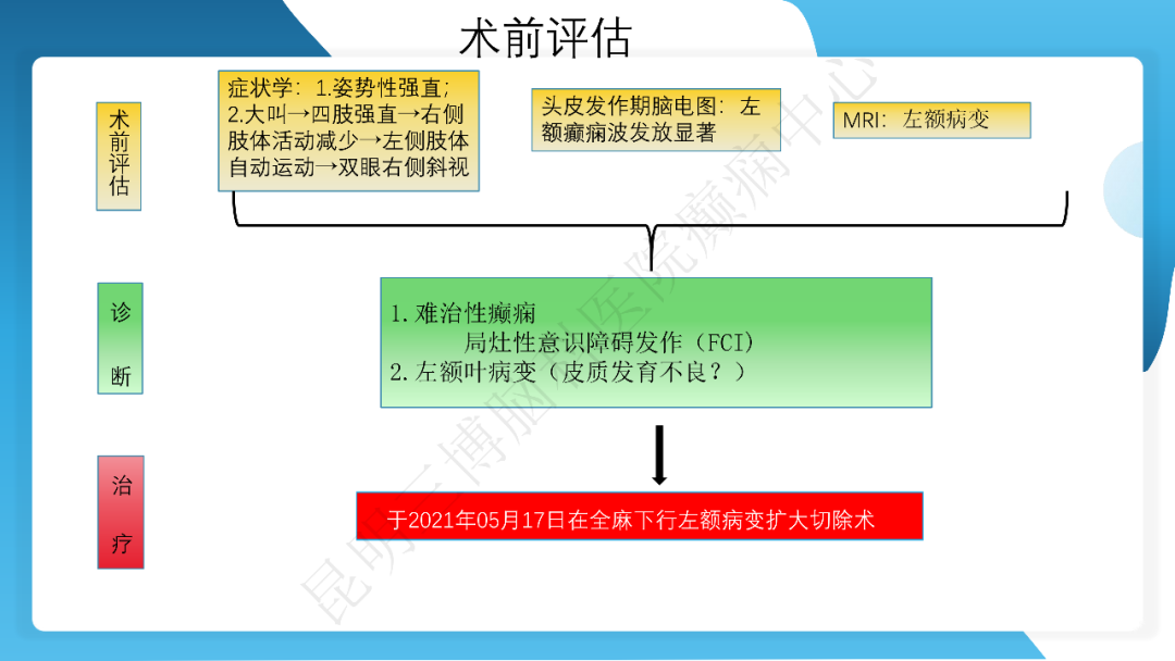 《「痫停」信步》癫痫治疗病例荟萃第四十二期---手术治疗孤立性皮层发育不良为表现的结节性硬化一例