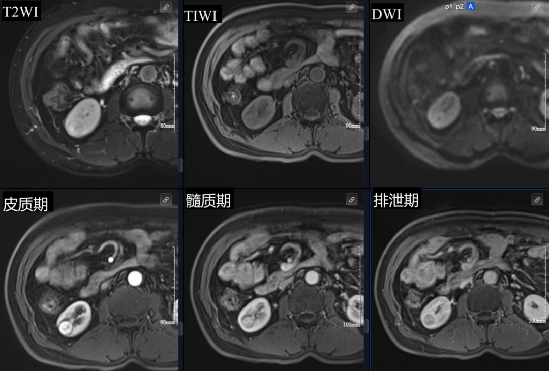 影像诊断的「关键 24 小时」:一次异常信号的快速追踪