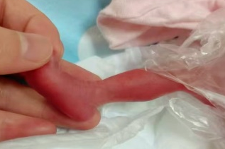 乳汁为桥，爱暖新生 ｜「掌心宝宝」 的 88 天守护记