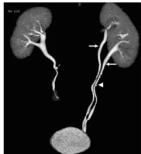 医学造影剂能喝吗？好喝吗？安全吗？