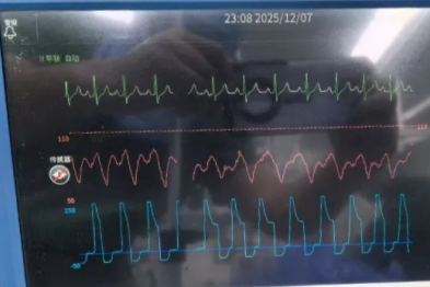 技术先锋 | 跨越国界的「心」生