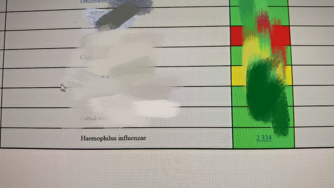同名？不同「命」！流感嗜血杆菌感染≠流感！