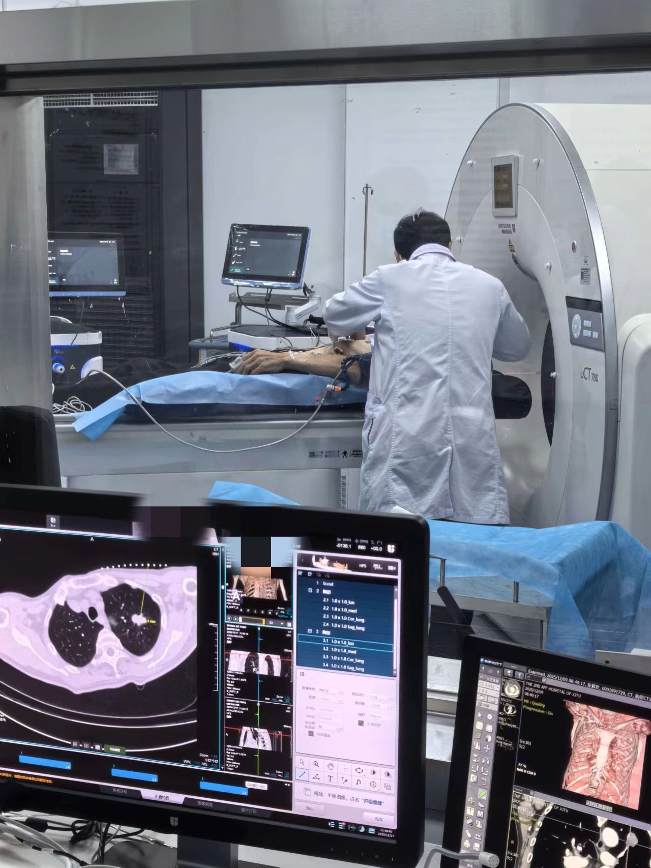 微创冷冻消融术助力多例肺肿瘤患者快速康复