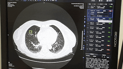 诊室里的扫码声—看看西安国际医学中心「便民就医」微改革