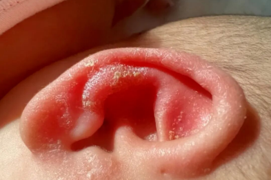 宝宝总挠耳朵？不是卖萌，可能是这几种健康信号！