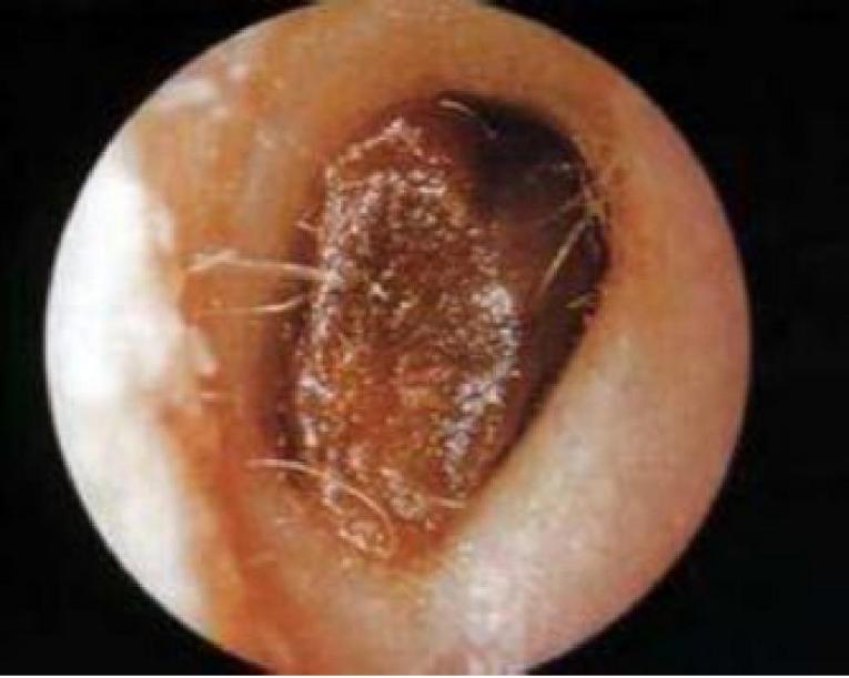 宝宝总挠耳朵?不是卖萌,可能是这几种健康信号!